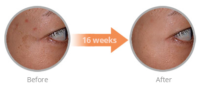 efficacy of soluble vitamin c